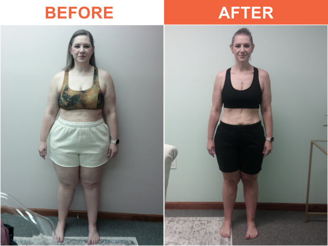 Weight Loss Clinic Chattanooga service