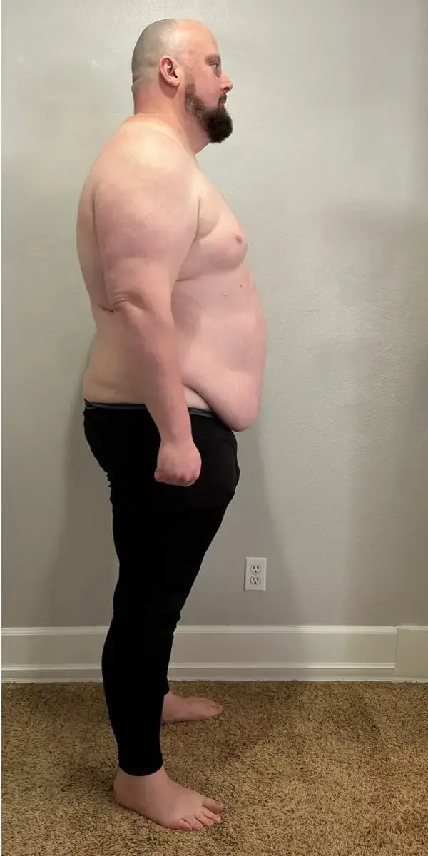 Bdub After Weight Loss with Be The Younger You
